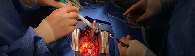 Ghardaia - Chirurgie vasculaire et cardiaque