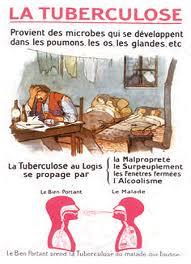 Oran - Une maladie en progression: Plus de 700 cas de tuberculose en huit mois