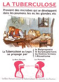 Oran - Une maladie en progression: Plus de 700 cas de tuberculose en huit mois