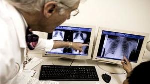 Planète - Journée mondiale de lutte contre la tuberculose: un million d'enfants malades chaque année