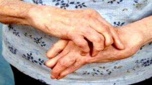 Environ 100.000 personnes atteintes de polyarthrite en Algérie