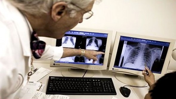 Planète - Journée mondiale de lutte contre la tuberculose: un million d'enfants malades chaque année