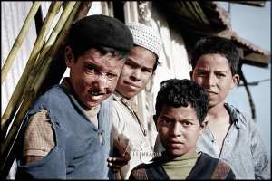 صورة التقطت سنة 1962 لطفل أصيب بالنبالم في منطقة القبائل.