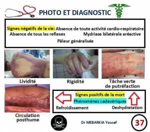 Signes positifs de la mort