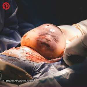 Les photos de ce bébé né dans une 