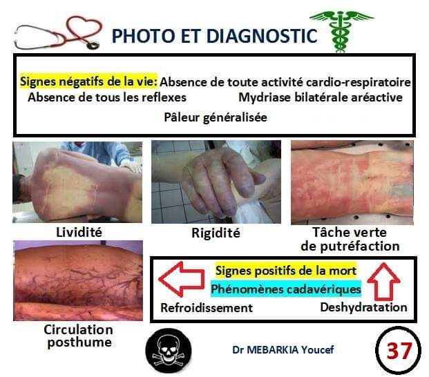 Signes positifs de la mort