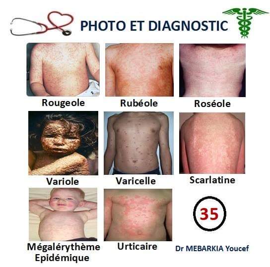 Éruptions en pédiatrie