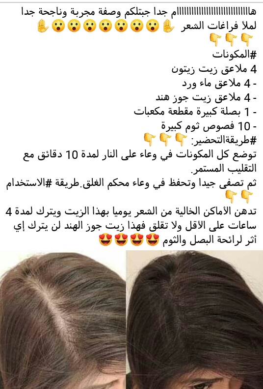 وصفة للشعر المتساقط