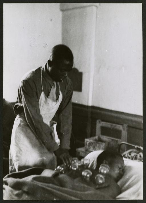 Alger 1944 - Régiment de tirailleurs sénégalais à Alger - Dans l'infirmerie une pose de ventouse (Image de propagande coloniale)