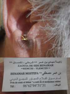 عرق لاسان هو الاسم الدارج في العامية الجزائرية (خاصة في منطقة تلمسان وما حولها) للإشارة إلى العرق النسا أو السكياتيك،