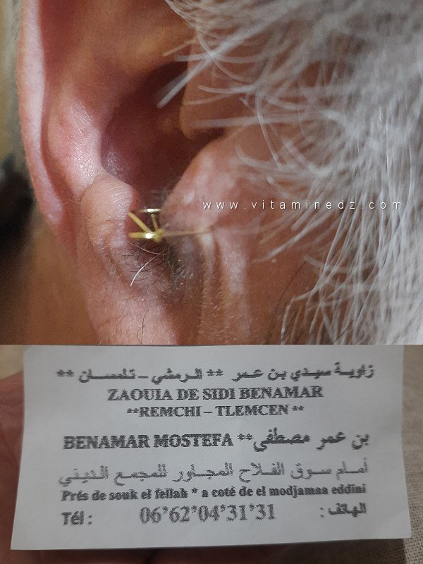 Zaouia Sidi Benamar à Remchi et la sciatique