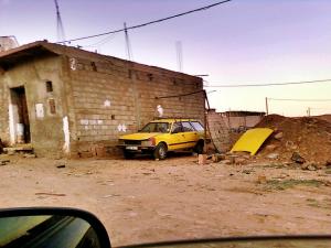 spina bifida A aflou Myelomeningocele